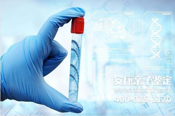 上海哪家医院是公安局指定做亲子鉴定的，关于DNA鉴定你都知道哪些？