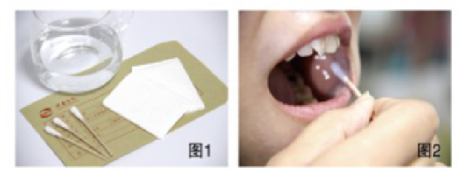 口腔拭子采样方法