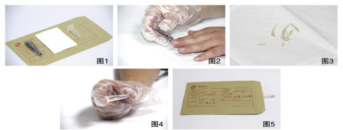 指甲采样方法