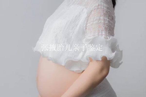 张掖胎儿亲子鉴定