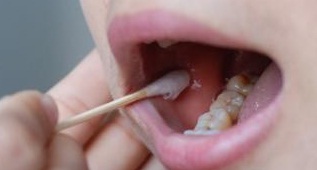 口腔黏膜