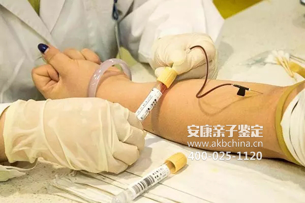 亲子鉴定验血早上能吃饭吗