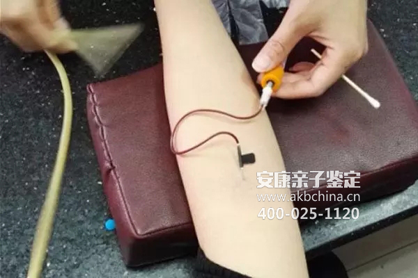 做个人亲子鉴定和亲子鉴定对样本要求的区别
