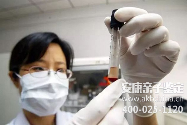 抽血亲子鉴定要等几天出结果?有什么能做亲子鉴定?