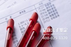 日照亲子鉴定多少钱能用于和？
